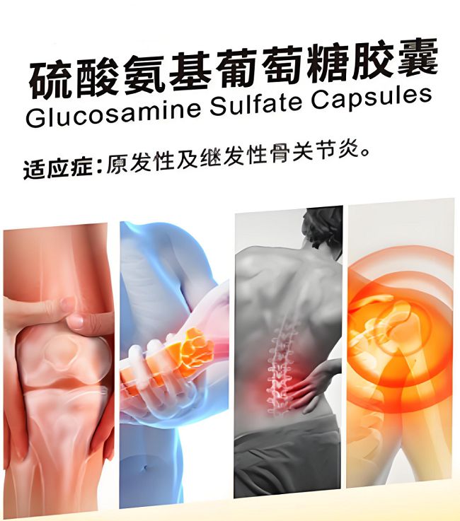 ——原发性关节炎养护知识科普球王会app美诺华谷力轻提醒(图2)